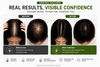 Hair Pro Max Hair Kit